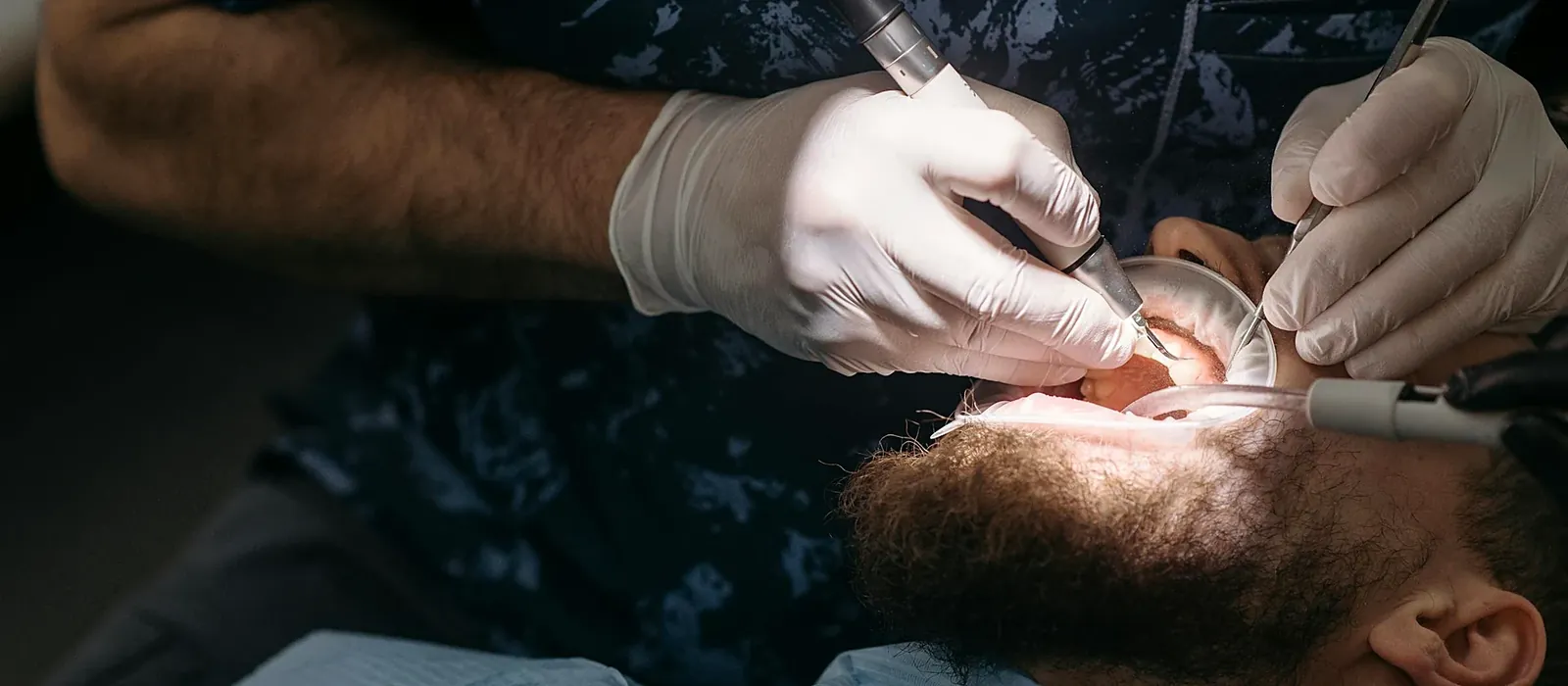 Injection Moulding at Bright Smiles - Savoy Dental Centre