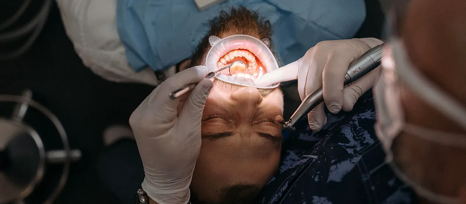 Restorative Care at Bright Smiles - Savoy Dental Centre