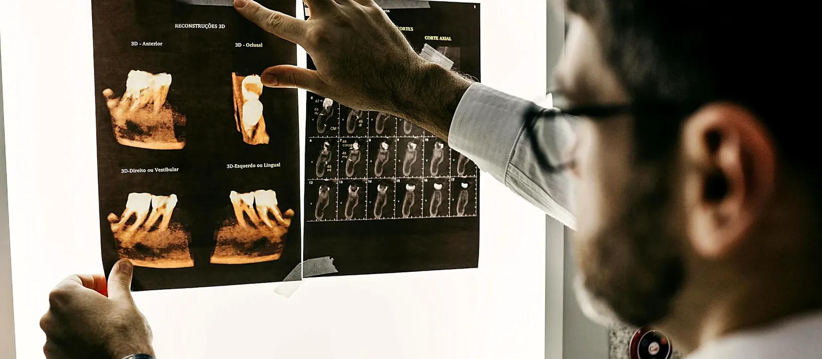 3D Smile Design at Bright Smiles - Savoy Dental Centre