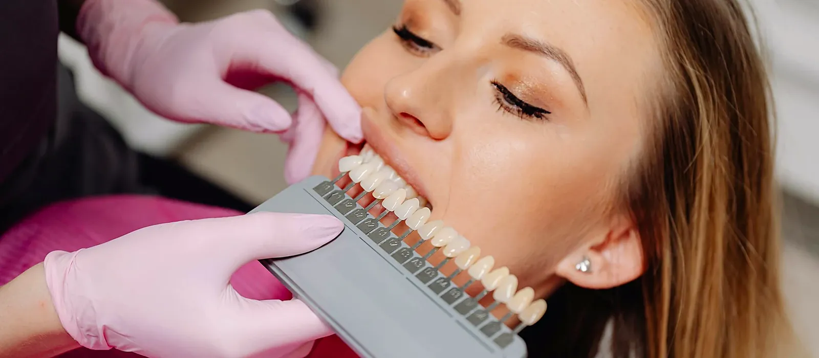 Veneers at Bright Smiles - Savoy Dental Centre